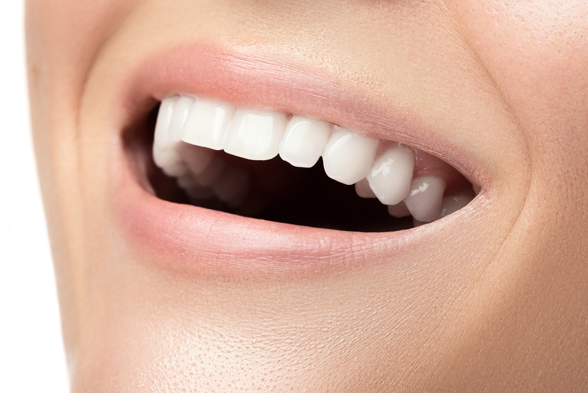 Tooth Whitening