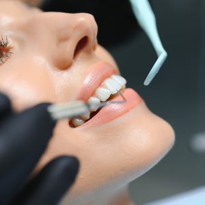 Doctor examining patient's teeth, closeup. Cosmetic dentistry