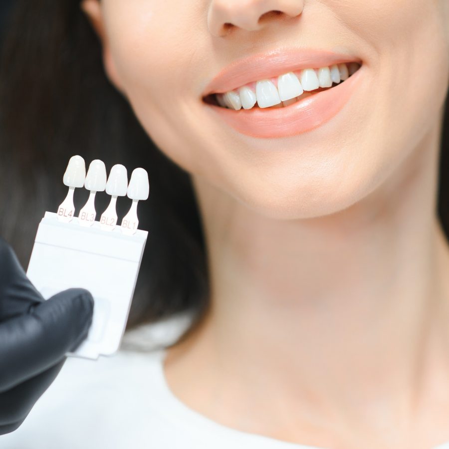 Doctor matching patient's teeth color with palette, closeup. Cosmetic dentistry